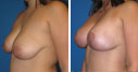 Before & After Photos